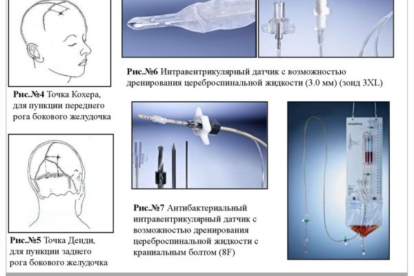 Кракен наркошоп сайт